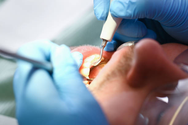 Best Weekend Emergency Dentist in Lake Fenton, MI