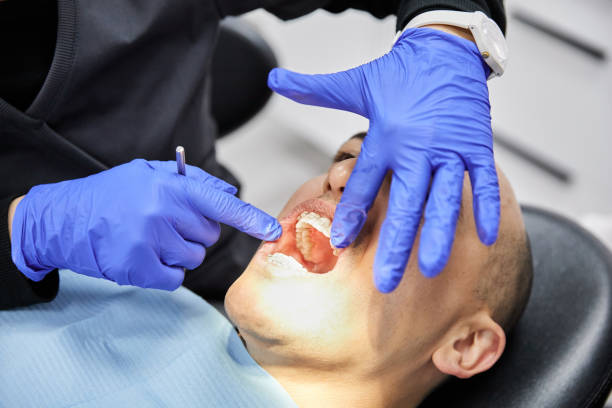 Best Emergency Broken Tooth Repair in Lake Fenton, MI